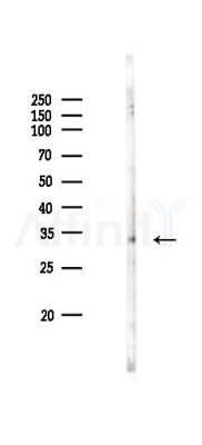 ASAH3L Antibody - Western blot analysis of lysates from RAW264.