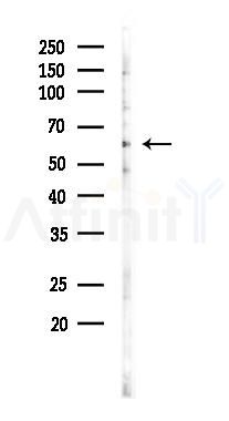 APBA3 Antibody - Western blot analysis of lysates from PC12 cells(LPS 4h treatment), using APBA3 Antibody at 1/1000 dilution.