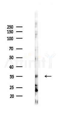 ARFIP1 Antibody - Western blot analysis of lysates from K562 cells(starvation 24h treatment), using ARFIP1 Antibody at 1/1000 dilution.