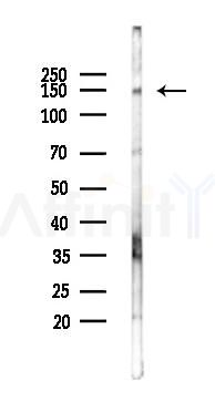 ATXN2 Antibody - Western blot analysis of lysates from B16F10-LUC cells(starvation 24h treatment), using ATXN2 Antibody at 1/1000 dilution.
