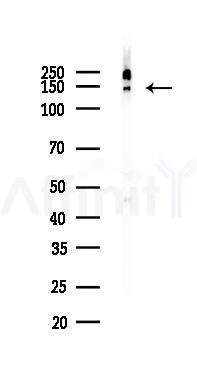 BCLAF1 Antibody - Western blot analysis of lysates from Rat brain, using BCLAF1 Antibody at 1/1000 dilution.