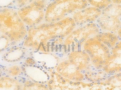 GLB1 Antibody - DF3842 at 1/100 staining human normal kidney tissue by IHC-P.