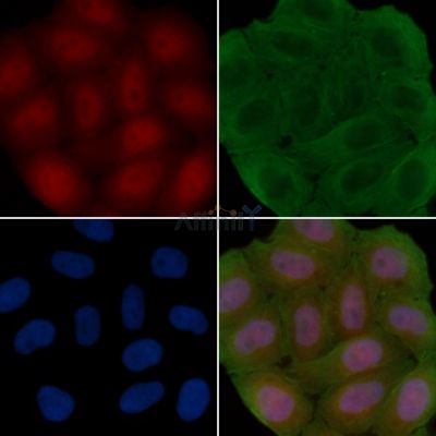 GLB1 Antibody - DF3842 staining Hela cells(30min of UV treatment) by IF/ICC.