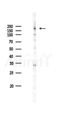 BAZ2A Antibody - Western blot analysis of lysates from RAW264.