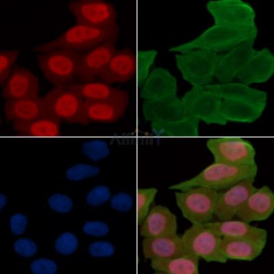 CABP7 Antibody - DF3863 staining Hela cells(24h of starvation treatment) by IF/ICC.