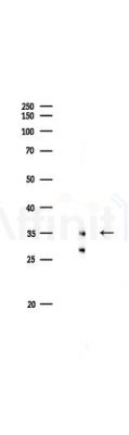 CHST8 Antibody - Western blot analysis of lysates from Rat brain, using CHST8 Antibody at 1/1000 dilution.