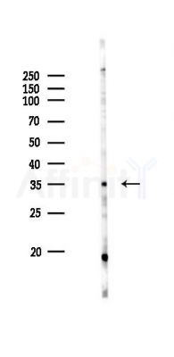 CHST8 Antibody - Western blot analysis of lysates from RAW264.