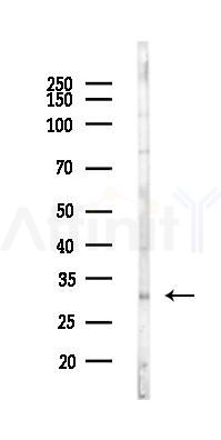 CA5B Antibody - Western blot analysis of lysates from Rat brain, using CA5B Antibody at 1/1000 dilution.