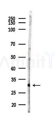 CBR3 Antibody - Western blot analysis of lysates from PC12 cells(starvation 24h treatment), using CBR3 Antibody at 1/1000 dilution.