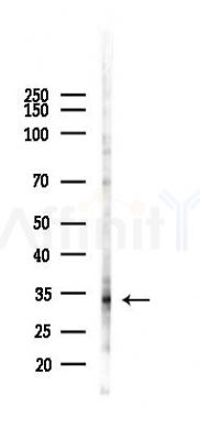 CEACAM21 Antibody - Western blot analysis of lysates from Hela cells(heat-shock 45min treatment), using CEACAM21 Antibody at 1/1000 dilution.