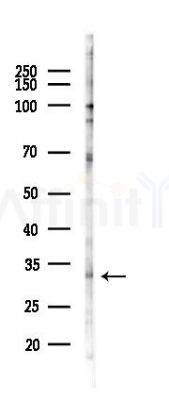 CEACAM21 Antibody - Western blot analysis of lysates from PC12 cells(starvation 24h treatment), using CEACAM21 Antibody at 1/1000 dilution.