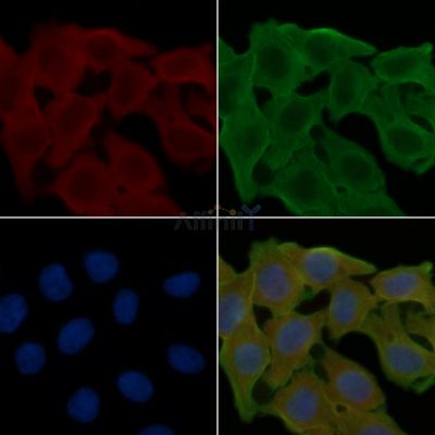 BORG1 Antibody - DF3908 staining Hela cells(24h of starvation treatment) by IF/ICC.
