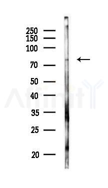 CLIC6 Antibody - Western blot analysis of lysates from EC304 cells(UV 30min treatment), using CLIC6 Antibody at 1/1000 dilution.