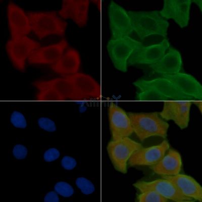 CCDC102A Antibody - DF3953 staining Hela cells(24h of starvation treatment) by IF/ICC.