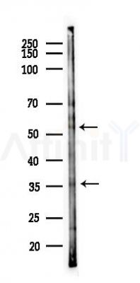 BEND4 Antibody - Western blot analysis of lysates from PC12 cells(starvation 24h treatment), using BEND4 Antibody at 1/1000 dilution.