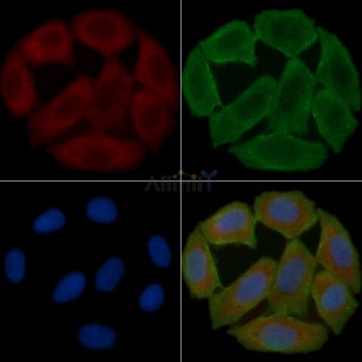CD55 Antibody - DF3965 staining Hela cells(30min of UV treatment) by IF/ICC.