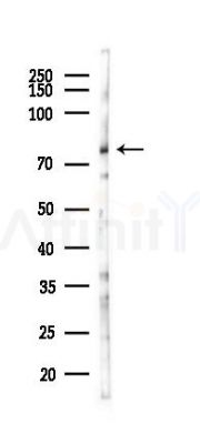 NCAPH Antibody - Western blot analysis of lysates from PC12 cells(starvation 24h treatment), using NCAPH Antibody at 1/1000 dilution.