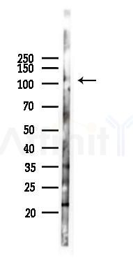 CNTN6 Antibody - Western blot analysis of lysates from Mouse lung, using CNTN6 Antibody at 1/1000 dilution.