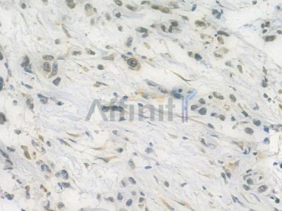 RPB11 Antibody - DF4003 at 1/100 staining human normal liver tissue by IHC-P.