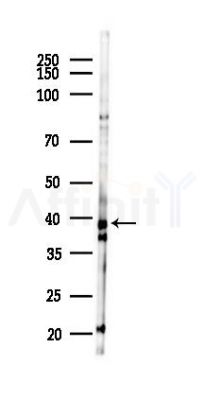 DNAJB11 Antibody - Western blot analysis of lysates from PC12 cells(starvation 24h treatment), using DNAJB11 Antibody at 1/1000 dilution.