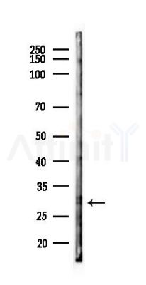 RNF138 Antibody - Western blot analysis of lysates from PC12 cells(starvation 24h treatment), using RNF138 Antibody at 1/1000 dilution.