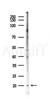 INSL4 Antibody - Western blot analysis of lysates from PC12 cells(starvation 24h treatment), using INSL4 Antibody at 1/1000 dilution.