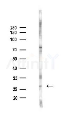 EIF3K Antibody - Western blot analysis of lysates from K562 cells(starvation 24h treatment), using EIF3K Antibody at 1/1000 dilution.