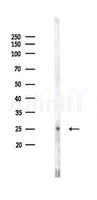 EIF3K Antibody - Western blot analysis of lysates from B16F10-LUC cells(starvation 24h treatment), using EIF3K Antibody at 1/1000 dilution.