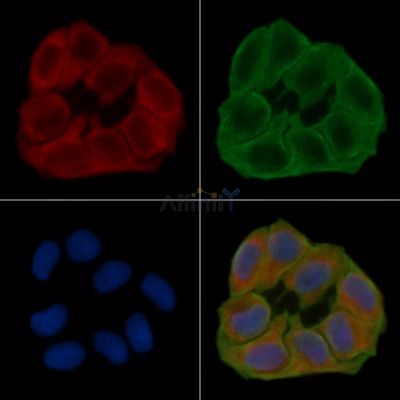 GABRG1 Antibody - DF4072 staining Hela cells(24h of starvation treatment) by IF/ICC.