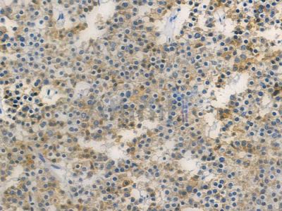 GORASP2 Antibody - DF4089 at 1/100 staining human pituitary adenoma by IHC-P.