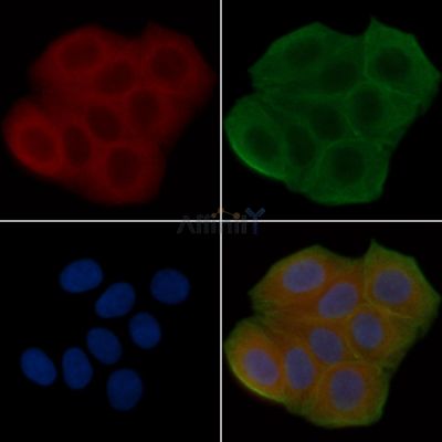 GORASP2 Antibody - DF4089 staining Hela cells(30min of UV treatment) by IF/ICC.