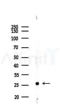 GRB2 Antibody - Western blot analysis of lysates from 293 cells(LPS 4h treatment), using GRB2 Antibody at 1/1000 dilution.
