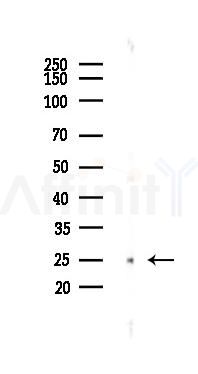 GRB2 Antibody - Western blot analysis of lysates from B16F10-LUC cells(starvation 24h treatment), using GRB2 Antibody at 1/1000 dilution.