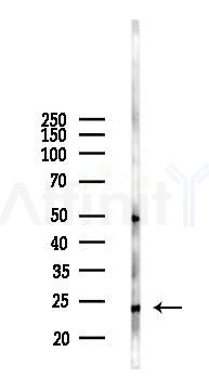 ERAS Antibody - Western blot analysis of lysates from HepG2 cells(UV 30min treatment), using ERAS Antibody at 1/1000 dilution.