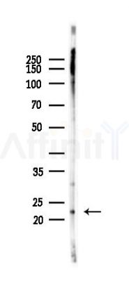 SAR1B Antibody - Western blot analysis of lysates from Rat brain, using SAR1B Antibody at 1/1000 dilution.