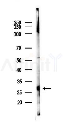 SAR1B Antibody - Western blot analysis of lysates from Hela cells(heat-shock 45min treatment), using SAR1B Antibody at 1/1000 dilution.