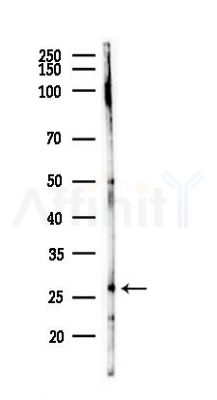 SAR1B Antibody - Western blot analysis of lysates from PC12 cells(starvation 24h treatment), using SAR1B Antibody at 1/1000 dilution.