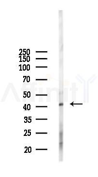 MAP9 Antibody - Western blot analysis of lysates from HepG2 cells(UV 30min treatment), using MAP9 Antibody at 1/1000 dilution.