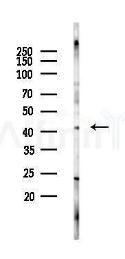 MAP9 Antibody - Western blot analysis of lysates from B16F10-LUC cells(heat-shock 45min treatment), using MAP9 Antibody at 1/1000 dilution.