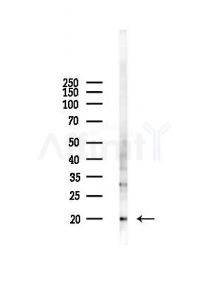 MRPL49 Antibody - Western blot analysis of lysates from HepG2 cells(UV 30min treatment), using MRPL49 Antibody at 1/1000 dilution.