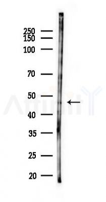 SLC9A3R2 Antibody - Western blot analysis of lysates from PC12 cells(starvation 24h treatment), using SLC9A3R2 Antibody at 1/1000 dilution.