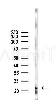 NDUFA8 Antibody - Western blot analysis of lysates from HepG2 cells(UV 30min treatment), using NDUFA8 Antibody at 1/1000 dilution.
