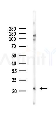 NDUFA8 Antibody - Western blot analysis of lysates from Rat testis, using NDUFA8 Antibody at 1/1000 dilution.