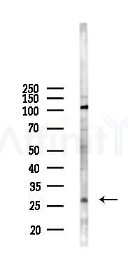 NPDC1 Antibody - Western blot analysis of lysates from HepG2 cells(UV 30min treatment), using NPDC1 Antibody at 1/1000 dilution.