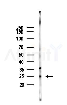 NRSN1 Antibody - Western blot analysis of lysates from Hela cells(heat-shock 45min treatment), using NRSN1 Antibody at 1/1000 dilution.