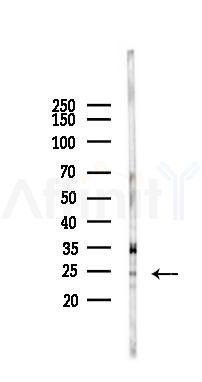 NMS Antibody - Western blot analysis of lysates from Hela cells(heat-shock 45min treatment), using NMS Antibody at 1/1000 dilution.
