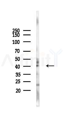 SEPT3 Antibody - Western blot analysis of lysates from Hela cells(heat-shock 45min treatment), using SEPT3 Antibody at 1/1000 dilution.