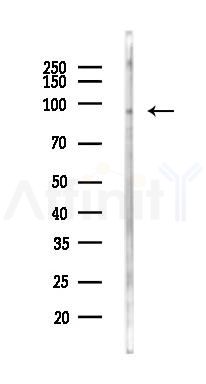 SP100 Antibody - Western blot analysis of lysates from Rat brain, using SP100 Antibody at 1/1000 dilution.