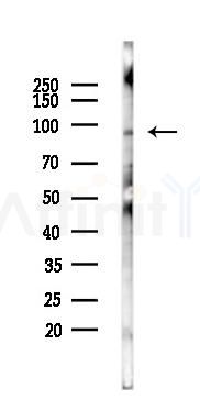 SP100 Antibody - Western blot analysis of lysates from B16F10-LUC cells(starvation 24h treatment), using SP100 Antibody at 1/1000 dilution.