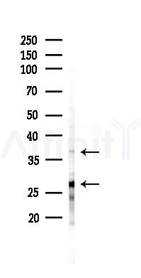 PPP1R8/ARD1 Antibody - Western blot analysis of lysates from PC12 cells(LPS 4h treatment), using PPP1R8/ARD1 Antibody at 1/1000 dilution.